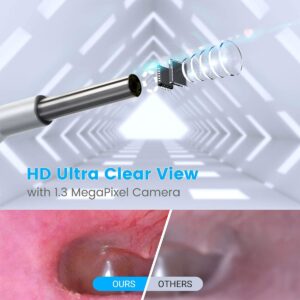 Waterproof Ear Wax Removal Tool w/ Endoscope & LED Lights