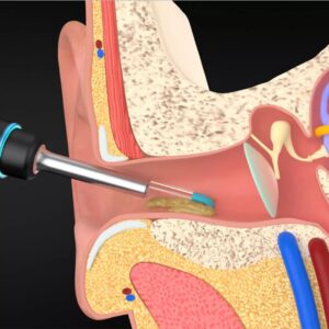 Xiaomi Mijia Bebird M9 Pro Smart Visual Ear Stick