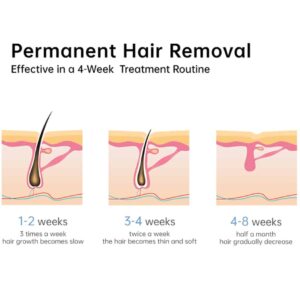 InFace IPL Laser Hair Removal